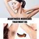 thumbnail image 4 of Pack of 2 Acanthosis Nigricans Treatment Oil 50ml, 4 of 4