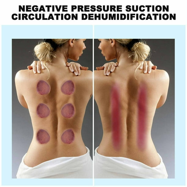 Juego de ventosas para masaje Gua Sha en 1, terapia de ventosas