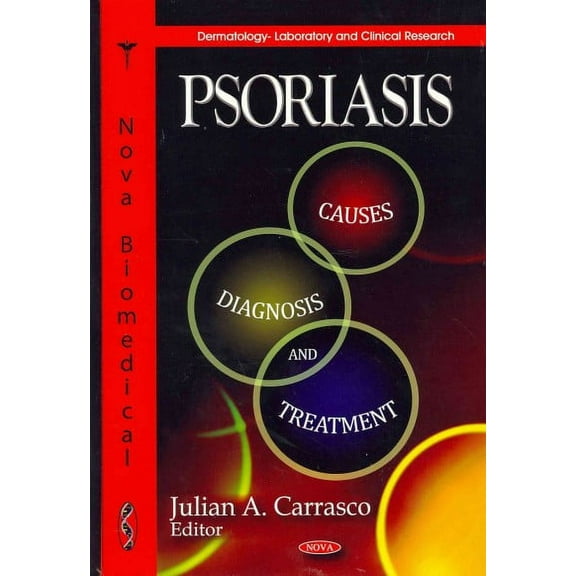 Psoriasis : Causes, Diagnosis and Treatment