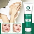 thumbnail image 4 of Hot6sl Ofertas Del Día Limpiador Blanqueador y Eliminador de Pecas Limpiador Facial y Control de Aminoácidos Degrasa Suave 120 G, 4 of 7