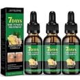 thumbnail image 1 of 3X 30ml Nails Care Repair Nail Fungal Anti-Fungus Onychomycosis-Removal Liquid Ginger Foot Antifungal Nail Treatments, 1 of 5