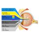 thumbnail image 5 of Gafas de protección láser Cloudray 1064 nm para fibra, seguridad, 5 of 7
