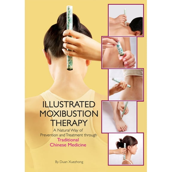Illustrated Moxibustion Therapy : A Natural Way of Prevention and Treatment through Traditional Chinese Medicine (Hardcover)