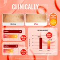 thumbnail image 2 of Pure Kojic | Jabón de Cuidado de la Piel | 2.82 oz (2 barras), 2 of 5