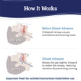 thumbnail image 2 of ZQuiet, Advance, Custom Anti-Snoring Mouthpiece, Adjustable Mouthguard with 4 Jaw Advancement Sizes, Slim & Low-Profile, Clear, 2 of 6