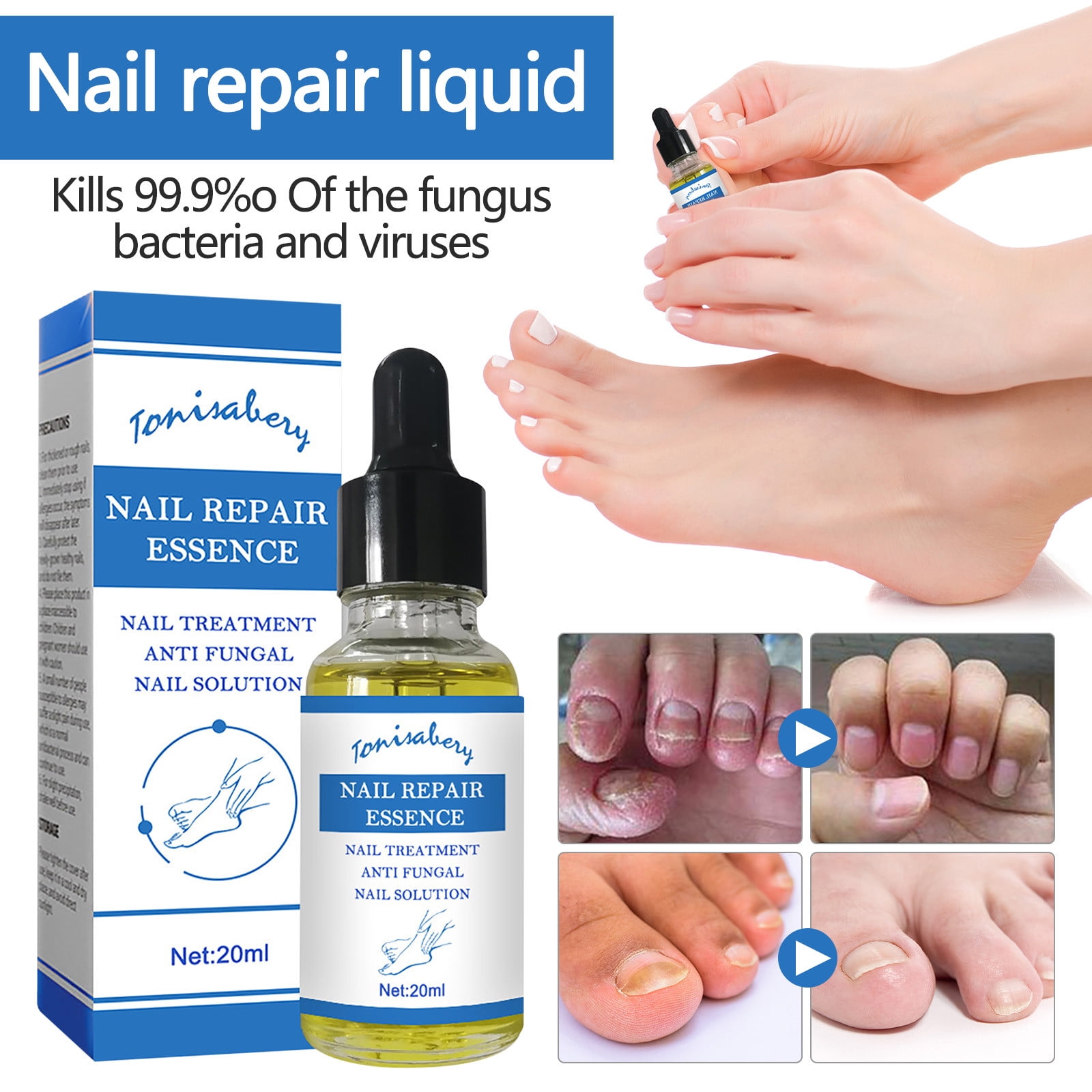 What is Longitudinal Ridging? | News-Medical | Nail health signs, Fingernail  health, Nail symptoms