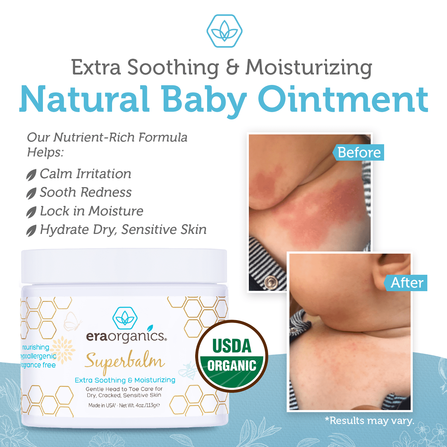 Era Organics Healing Ointment for Babies - USDA Certified Organic Natural Gentle Moisturizer for Sensitive Skin Prone To Baby Eczema, Cradle Cap, Rashes, Hives & More Super Balm 4 Ounce