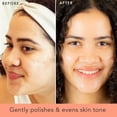 thumbnail image 2 of Exfoliante facial Beauty by Earth Microdermabrasion con gel natural, 2 of 7