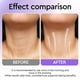 thumbnail image 3 of Crema reafirmante de cuello ORLASKIN Retinol para rostro y cuello antienvejecimiento 50 ml, 3 of 9