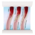 thumbnail image 1 of Manikin Body Plastic Ldl Model Plastic Teaching Model Dynamic Ldl Model Blood Vessel Anatomy Model Artery Vein Model, 1 of 3
