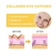 thumbnail image 5 of Parches antienvejecimiento para arrugas faciales para líneas de expresión con ácido hialurónico y vitamina E - Tratamiento nocturno para reafirmar, hidratar, reducir las líneas finas - Diseño cómodo, 5 of 7