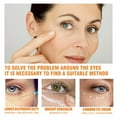 Repairing Eye To Lighten The Bags Under The Dark Circles And Improves
