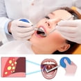 thumbnail image 4 of Portable Tonsils Stone Remover With Right Angle Tube Easy Carry Tonsillolith Stone Remover For Adults Use, 4 of 5