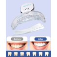 thumbnail image 3 of MySmile Teeth Whitening Strips with Light, 28X Non-Sensitive White Strips, 3 of 4