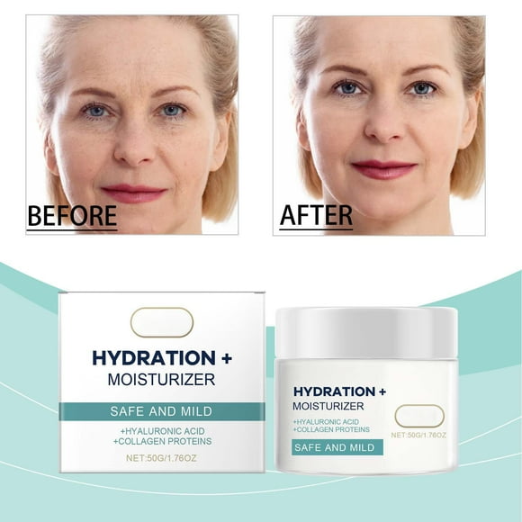 Hot6sl Relief Cream - Moisturising Cream For The Face For Oily Soothing Moisturising Care Ointment Cream Vegan 50g