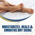thumbnail image 3 of Crema para pies Gold Bond Healing con aloe, 120 ml, nutre y suaviza, 3 of 8
