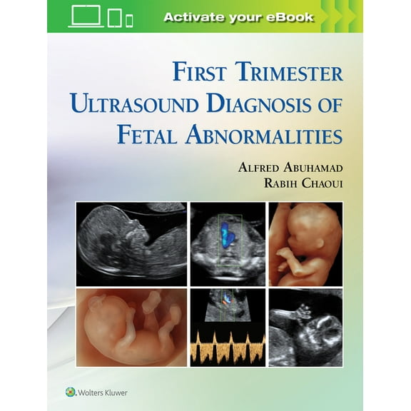 First Trimester Ultrasound Diagnosis of Fetal Abnormalities, (Hardcover)