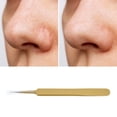 thumbnail image 5 of Unique Bargains 1 Pc Convenient Double Headed Pimple Extractor Gold Tone, 5 of 7