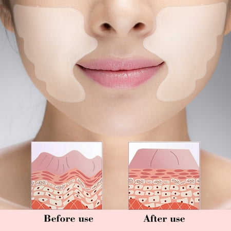Facial Lip Wrinkle Remover Pad Reusable Medical Grade Silicone Nasolabial Folds Anti-aging Mask Prevent Face
