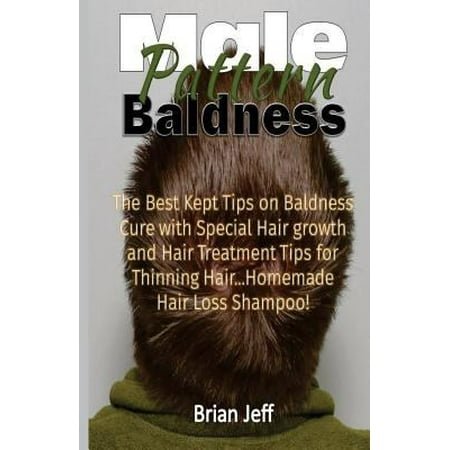 Male Pattern Baldness: The Best Kept Tips on Baldness Cure With Special Hair Growth and Hair Treatment Tips for Thinning Hair. homemade Hair Loss Shampoo!