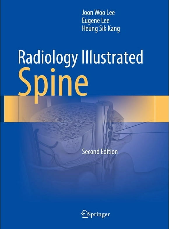 Radiology Illustrated Radiology Illustrated: Spine, 2nd 2023 ed. (Hardcover)