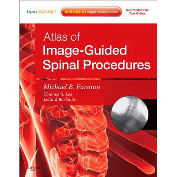 Pre-Owned Atlas of Image-Guided Spinal Procedures: Expert Consult - Online and Print (Hardcover) 0323042996 9780323042994