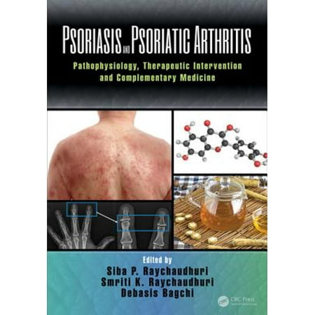 Psoriasis and Psoriatic Arthritis - eBook (Best Diet For Psoriatic Arthritis)
