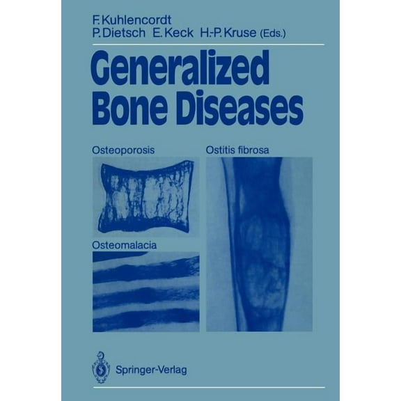 Generalized Bone Diseases: Osteoporosis Osteomalacia Ostitis Fibrosa, (Paperback)