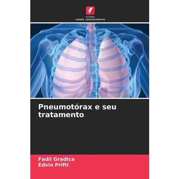 PneumotÃ³rax e seu tratamento, (Paperback)