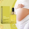thumbnail image 4 of Skin Oil Tender And Smooth Skin Gentle Moisturizing And Improving Skin Texture 30ml, 4 of 5