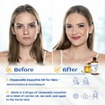 thumbnail image 2 of HIQILI Chamomile Essential Oil, 100mL Pure Plant Oil for Skin, Diffuser, Hair, Aromatherapy, Shampoo, 2 of 5