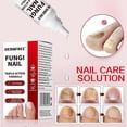 thumbnail image 3 of Nail Care Renewal Liquid for Thick Damage Discolored Nails, Fast-Acting Antifungals Repairs Discolored Nails, for Nails Care Supplies, 3 of 5