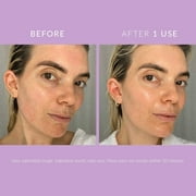 Kate Somerville DeliKate Recovery Cream