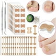 thumbnail image 1 of LNGOOR Ingrown Toenail Tool Set  Corrector Pedicure Tools  152 Pieces Curved Nail Tools  Ingrown Toenail Correction Patch  Toenail File  Lifter  for Ingrown Toenails, 1 of 8