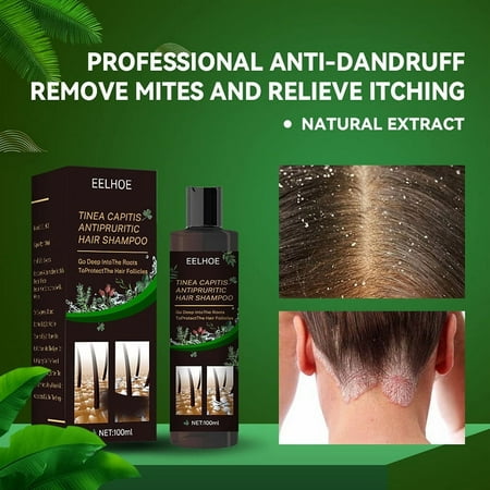 Hair Shampoo for Tinea Capitis Antipuritic Professional Antidandruff Remove Mites and Relieve Itching Shampoo 100ml