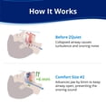 thumbnail image 2 of ZQuiet, Anti-Snoring Mouthpiece, Comfort Size #2, Single Refill, Blue Made in USA, BPA-Free, Medical-Grade Material, 2 of 6