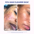 thumbnail image 4 of The Original MakeUp Eraser Cloud Clean Daily Face Towels XL - 50 Count, 4 of 11
