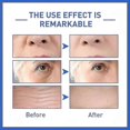 thumbnail image 4 of suitable for 2024 New Anti-aging Serum, Youthfully Face Serum, Dark Spot Corrector & Anti-aging Collagen Serum, Collagen Boost Anti-aging, 4 of 4