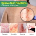 thumbnail image 3 of Pomada antiprurítica de menta, crema antibacteriana para tratamiento de Eczema, Dermatitis, medicina china, 1/3/5 unidades, 3 of 4