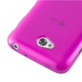 thumbnail image 4 of Cadorabo Case for LG L70 (1.SIM) Cover Screen Protection TPU Silicone Gel Brushed Back case, 4 of 4