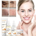 thumbnail image 2 of Set de Cúrcuma Cúrcuma + Manteca de Cúrcuma + Limpiador Facial de Cúrcuma + Mascarilla de Barro de Cúrcuma 60 ml + 100 ml, 2 of 4