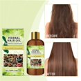 thumbnail image 4 of Aceite Natural para el Crecimiento del Cabello 100ml - Tratamiento Reparador Capilar a Base de Hierbas con Aceites Esenciales para la Prevención de la Caída del Cabello - Suero Nutritivo Profundo, 4 of 7