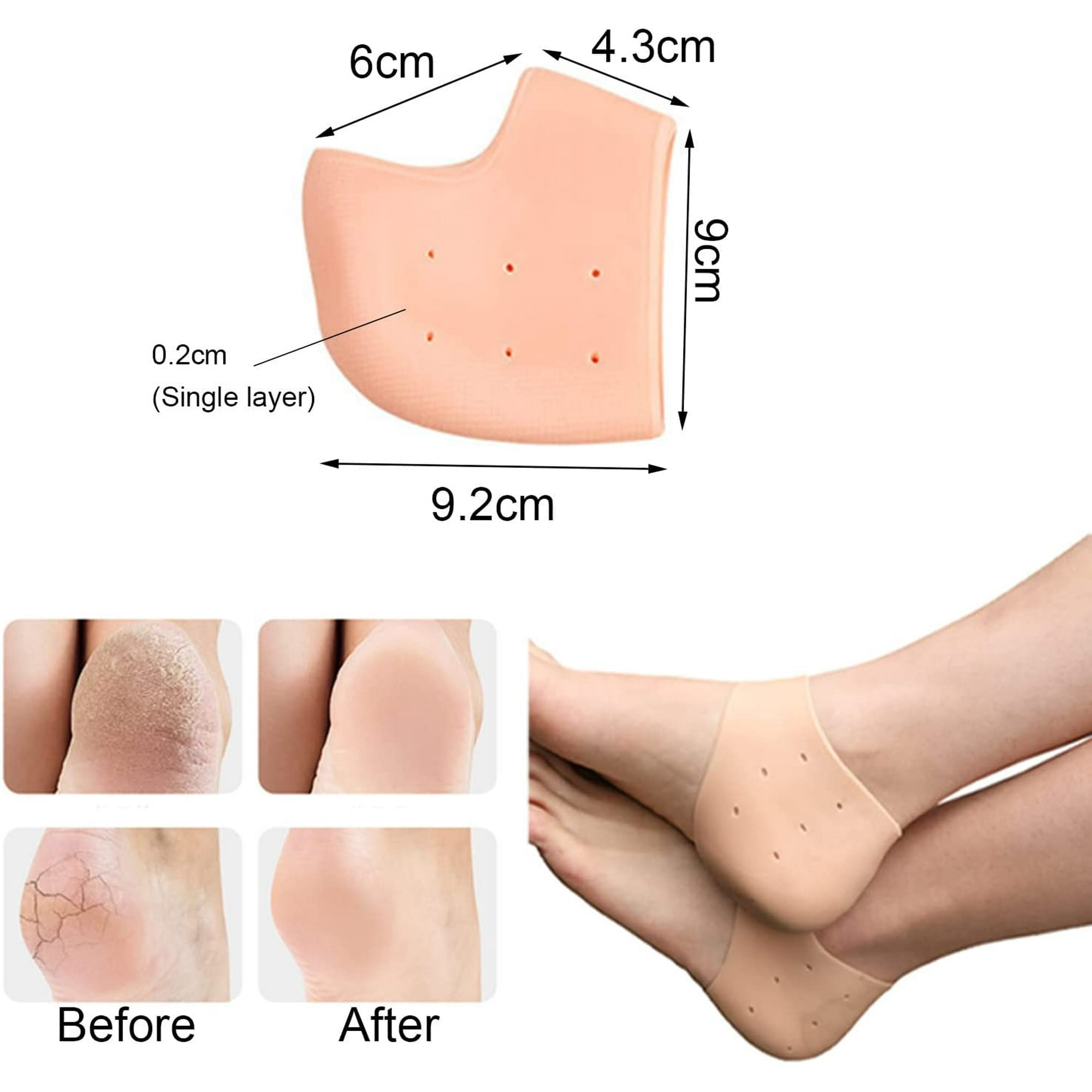 ShenMo Set of 2 Pairs Transparent Beige Silicone Heel Protectors Plantar Pads for Men Women Heels Calcanean Spur Dr Martens Shoe Protection Anti Pain Cracks Calluses Foot Walmart