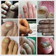thumbnail image 5 of Tratamiento de uñas AFeng 10ml, 5 of 5