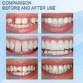 thumbnail image 3 of White Moldable Particles for Temporary Tooth Repair, 30ml Reusable Non-Toxic Smile Restoration Solution, 3 of 5