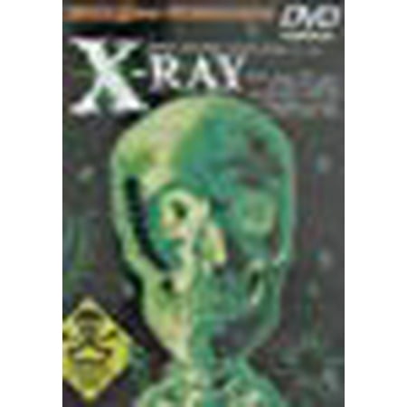 X-ray Steering - X-Ray