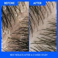 thumbnail image 2 of Head & Shoulders Old Spice Swagger Shampooing Antipelliculaire pour Hommes, 2 of 9