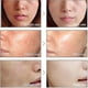 thumbnail image 1 of Suero facial blanqueador de vitamina C, aclara las manchas, aclara la esencia de la piel del rostro, desvanece las manchas oscuras, elimina las pecas y el cuidado de las manchas. kaili Sencillez, 1 of 3