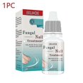 thumbnail image 1 of 10ml Fungal Nail Treatment Nail Foot Whitening Toe Fungus Removal Feet Care Repair Nail For O, 1 of 5