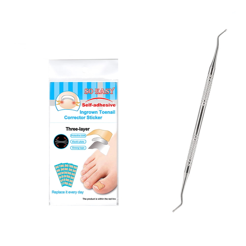 Aibecy Ingrown Nail Correction Kit Ingrown Toenail Stickers Lifter Straightening Recover Corrector Toe Nail Fingernail Care Tool - Walmart.com Aibecy Ingrown Nail Correction Kit Ingrown Toenail Stickers Lifter Straightening Recover Corrector Toe Nail Fingernail Care Tool - Walmart.com